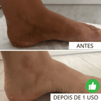 Luva Esfoliante Skinsolution