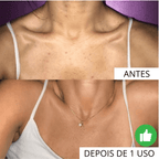 Luva Esfoliante Skinsolution