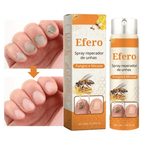 Efero Spray - Restaura Unhas e Elimina Fungos