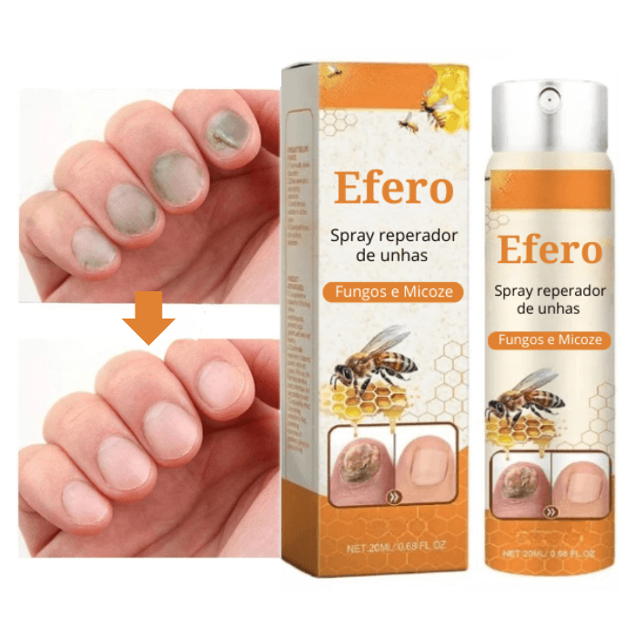 Efero Spray - Restaura Unhas e Elimina Fungos