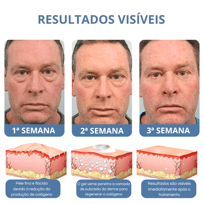 Creme Veze - Levanta Pálpebras Caídas e Reduz Rugas Dos Olhos