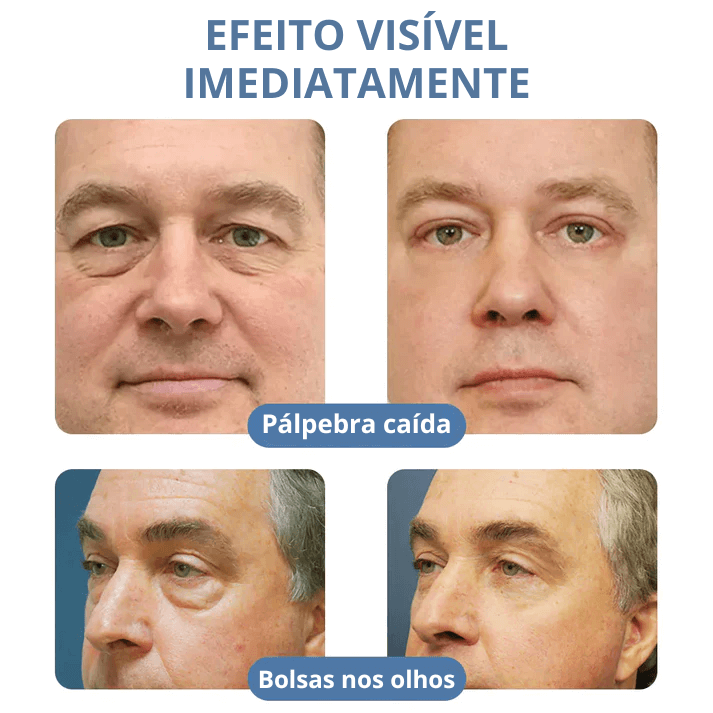 Creme Veze - Levanta Pálpebras Caídas e Reduz Rugas Dos Olhos