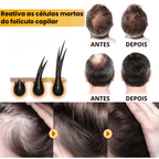 Sérum Para Crescimento Capilar - Biotin™ 7 Dias