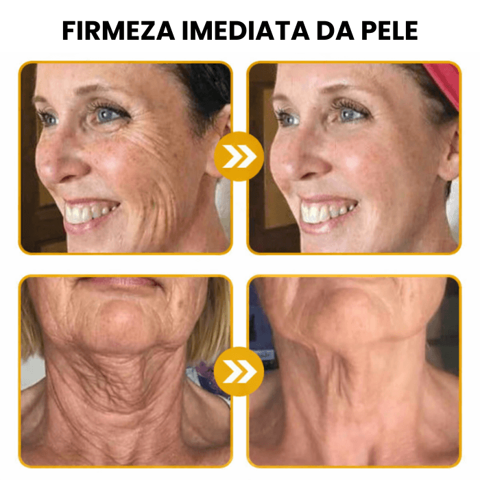 Creme Firming - Reduz a Flacidez e Modela Seu Corpo