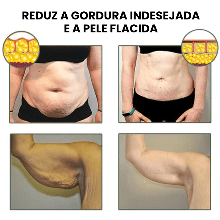 Creme Redutor e Firmador De Medidas - Firming