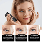 Creme Celyn - Levanta Pálpebras Caídas e Reduz Rugas Dos Olhos