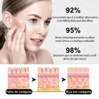 Creme Celyn - Levanta Pálpebras Caídas e Reduz Rugas Dos Olhos